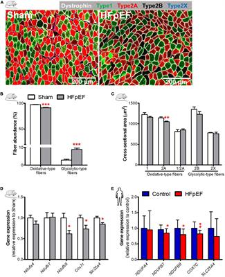 Skeletal muscle phenotypic switching in heart failure with preserved ejection fraction